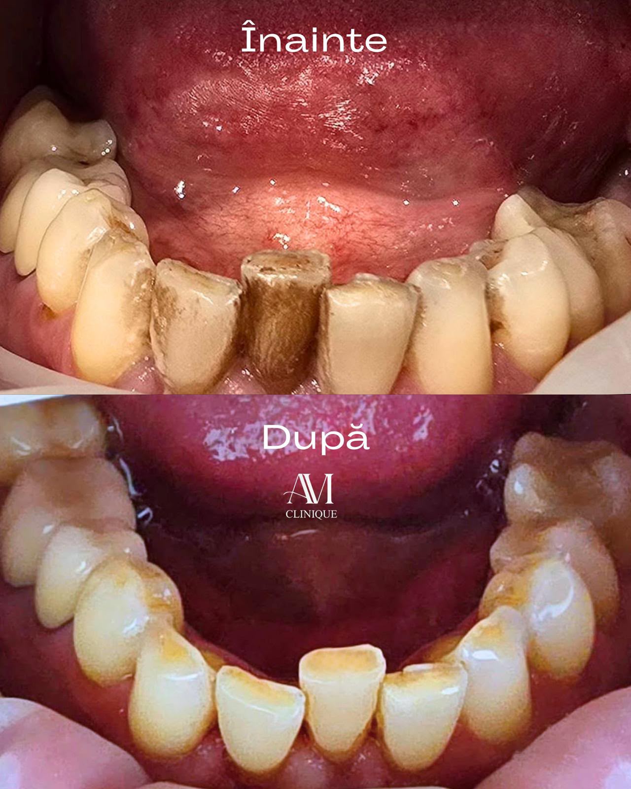 Îngrijire dentară, după