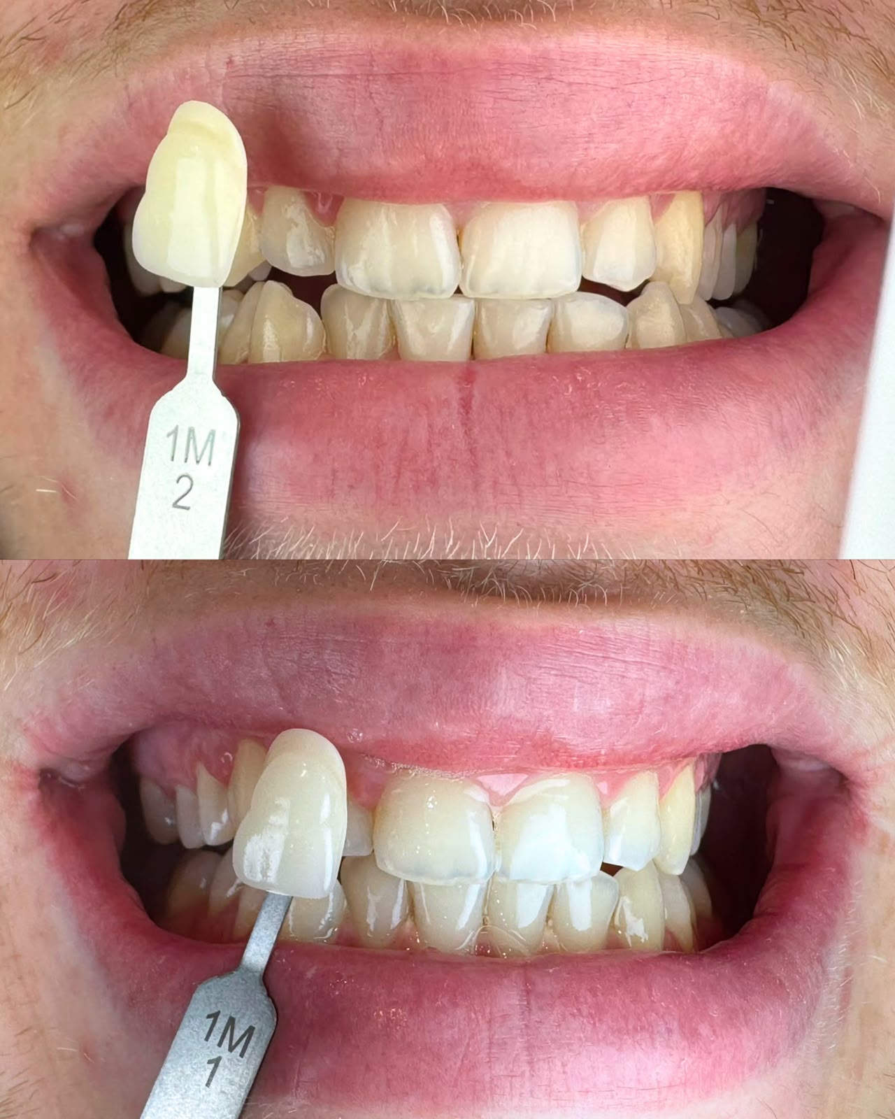 Îngrijire dentară, după