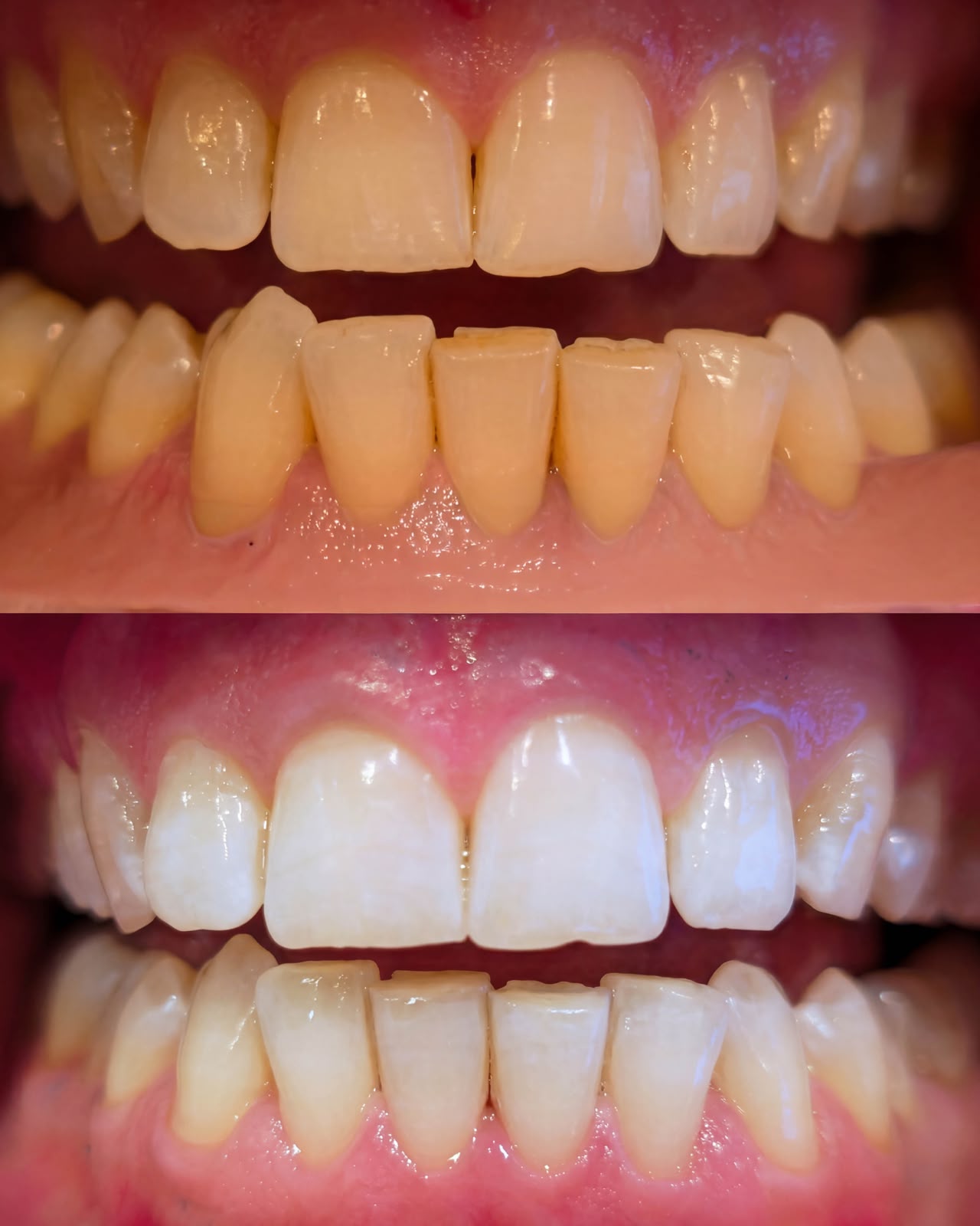 Îngrijire dentară, după